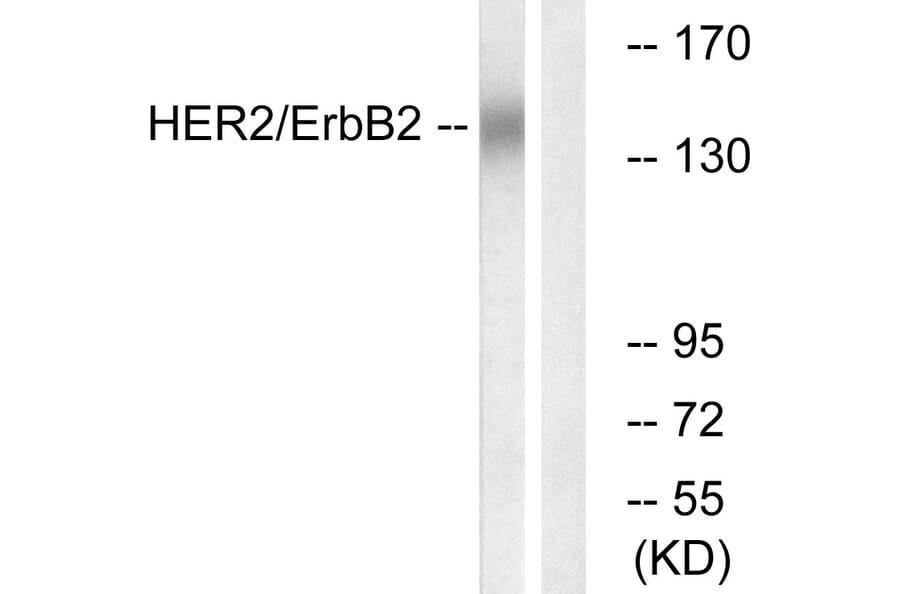Western Blot - Anti-HER2 Antibody (B0942) - Antibodies.com