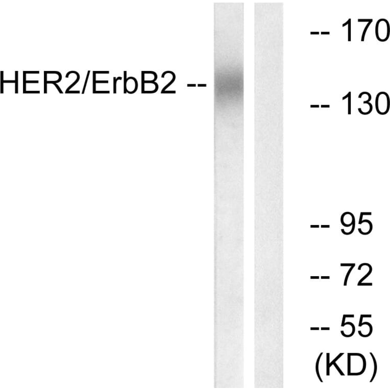 Western Blot - Anti-HER2 Antibody (B0942) - Antibodies.com