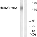Western Blot - Anti-HER2 Antibody (B0942) - Antibodies.com