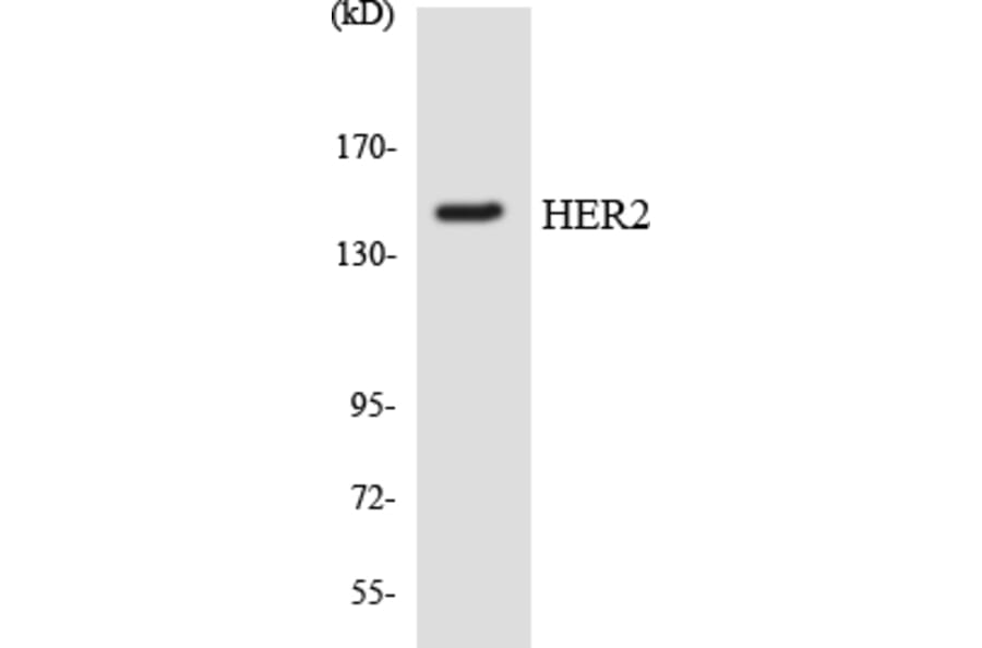 Western Blot - Anti-HER2 Antibody (R12-2872) - Antibodies.com
