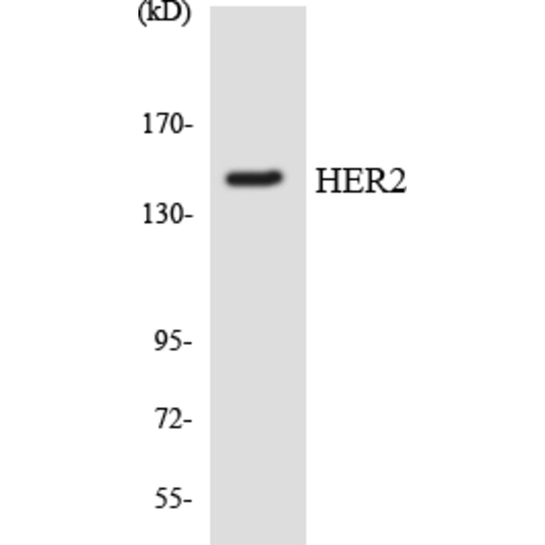 Western Blot - Anti-HER2 Antibody (R12-2872) - Antibodies.com