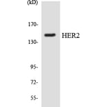 Western Blot - Anti-HER2 Antibody (R12-2872) - Antibodies.com
