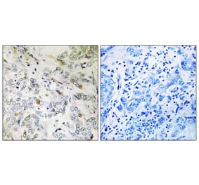 Immunohistochemistry - Anti-HCC1 Antibody (C17106) - Antibodies.com