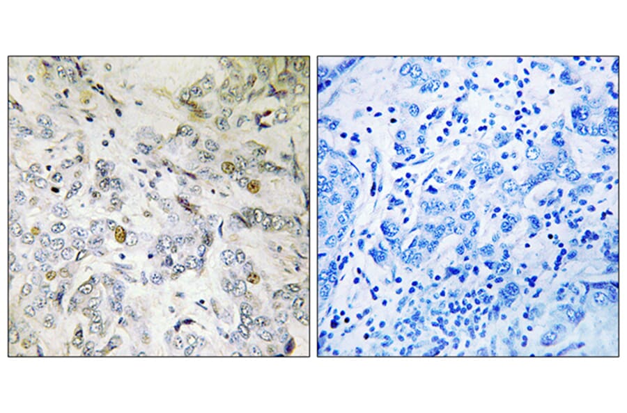 Immunohistochemistry - Anti-HCC1 Antibody (C17106) - Antibodies.com