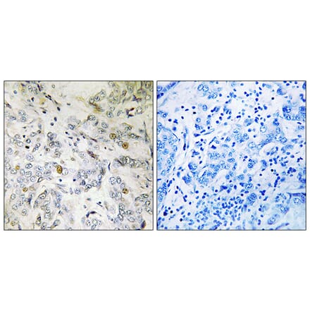 Immunohistochemistry - Anti-HCC1 Antibody (C17106) - Antibodies.com