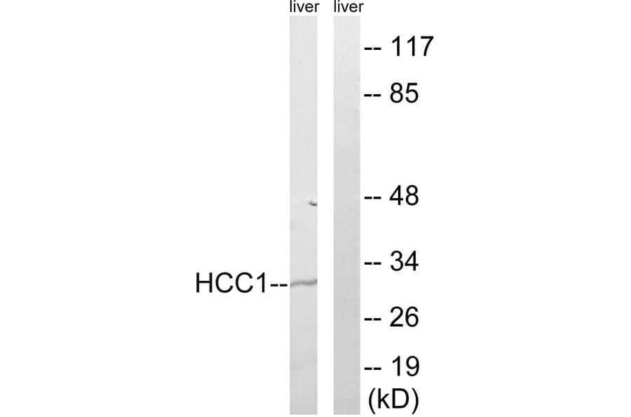 Western Blot - Anti-HCC1 Antibody (C17106) - Antibodies.com