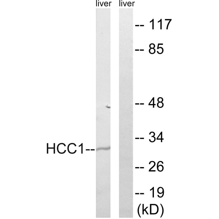 Western Blot - Anti-HCC1 Antibody (C17106) - Antibodies.com