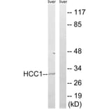 Western Blot - Anti-HCC1 Antibody (C17106) - Antibodies.com