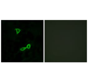 Immunofluorescence - Anti-GRM2 Antibody (G364) - Antibodies.com