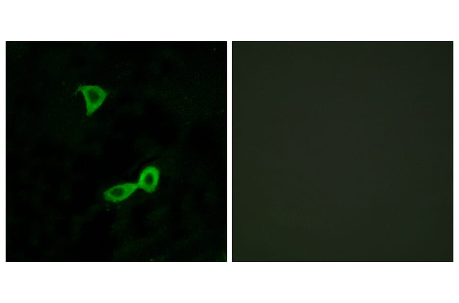 Immunofluorescence - Anti-GRM2 Antibody (G364) - Antibodies.com