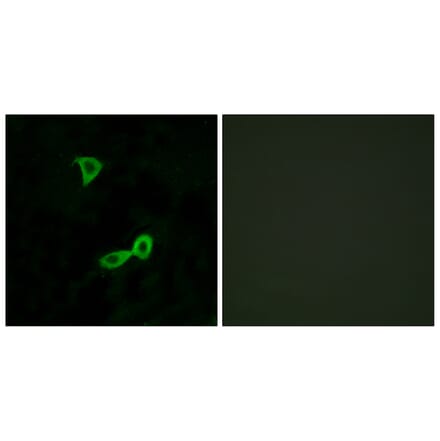 Immunofluorescence - Anti-GRM2 Antibody (G364) - Antibodies.com