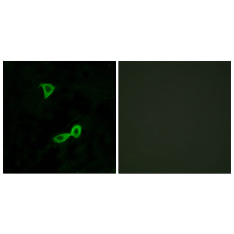 Immunofluorescence - Anti-GRM2 Antibody (G364) - Antibodies.com