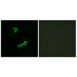 Immunofluorescence - Anti-GRM2 Antibody (G364) - Antibodies.com