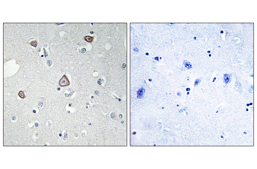 Immunohistochemistry - Anti-GRM2 Antibody (G364) - Antibodies.com