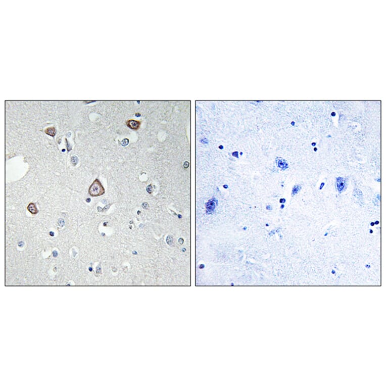 Immunohistochemistry - Anti-GRM2 Antibody (G364) - Antibodies.com