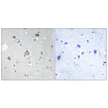 Immunohistochemistry - Anti-GRM2 Antibody (G364) - Antibodies.com