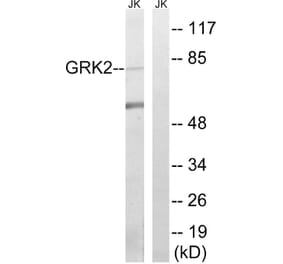 Western Blot - Anti-GRK2 Antibody (B8278) - Antibodies.com