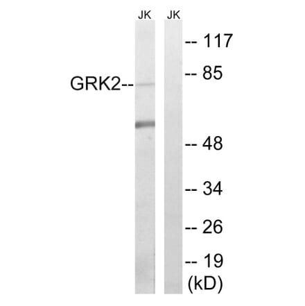 Western Blot - Anti-GRK2 Antibody (B8278) - Antibodies.com