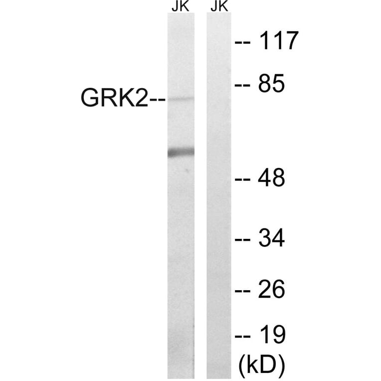 Western Blot - Anti-GRK2 Antibody (B8278) - Antibodies.com