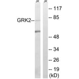 Western Blot - Anti-GRK2 Antibody (B8278) - Antibodies.com