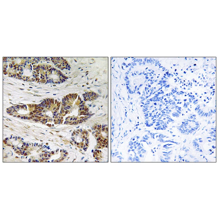 Immunohistochemistry - Anti-GRK2 Antibody (B8278) - Antibodies.com
