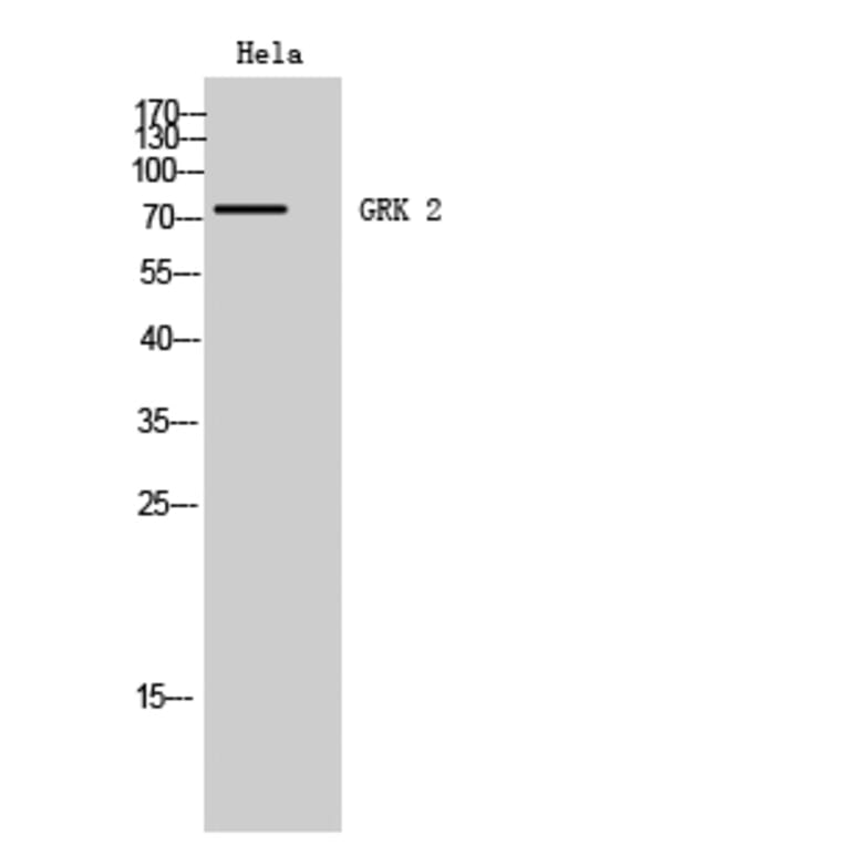 Western Blot - Anti-GRK2 Antibody (B8278) - Antibodies.com