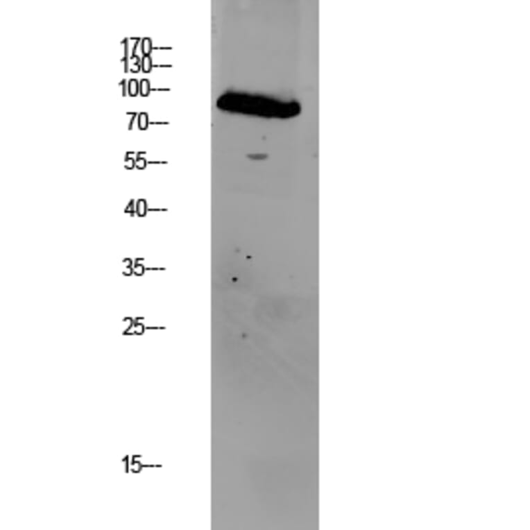 Western Blot - Anti-GRK2 Antibody (B8278) - Antibodies.com
