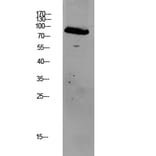 Western Blot - Anti-GRK2 Antibody (B8278) - Antibodies.com