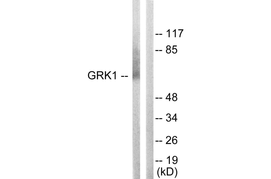 Western Blot - Anti-GRK1 Antibody (B0937) - Antibodies.com