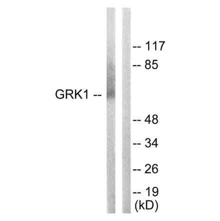 Western Blot - Anti-GRK1 Antibody (B0937) - Antibodies.com