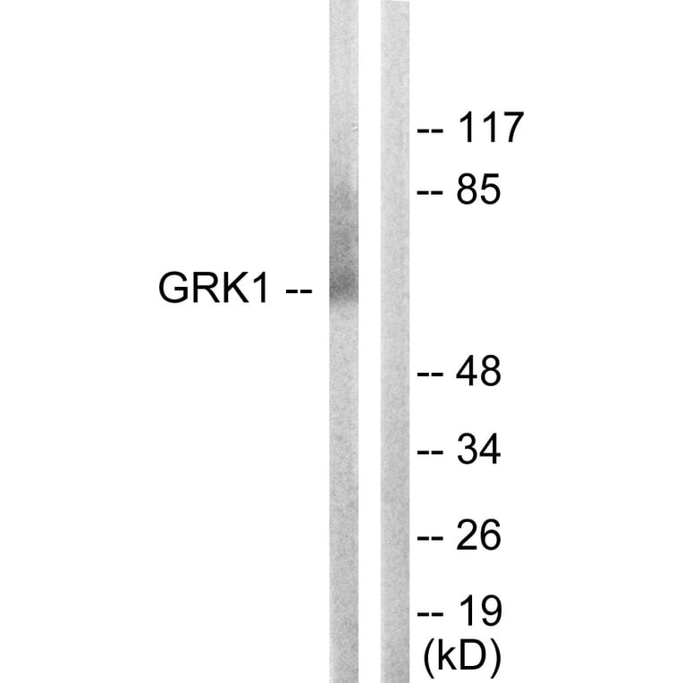 Western Blot - Anti-GRK1 Antibody (B0937) - Antibodies.com