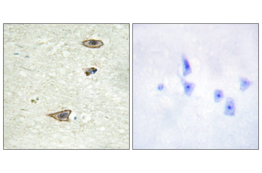 Immunohistochemistry - Anti-GRK1 Antibody (B0937) - Antibodies.com