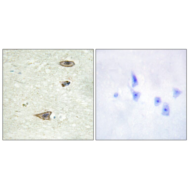Immunohistochemistry - Anti-GRK1 Antibody (B0937) - Antibodies.com
