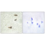 Immunohistochemistry - Anti-GRK1 Antibody (B0937) - Antibodies.com