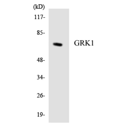 Western Blot - Anti-GRK1 Antibody (R12-2857) - Antibodies.com