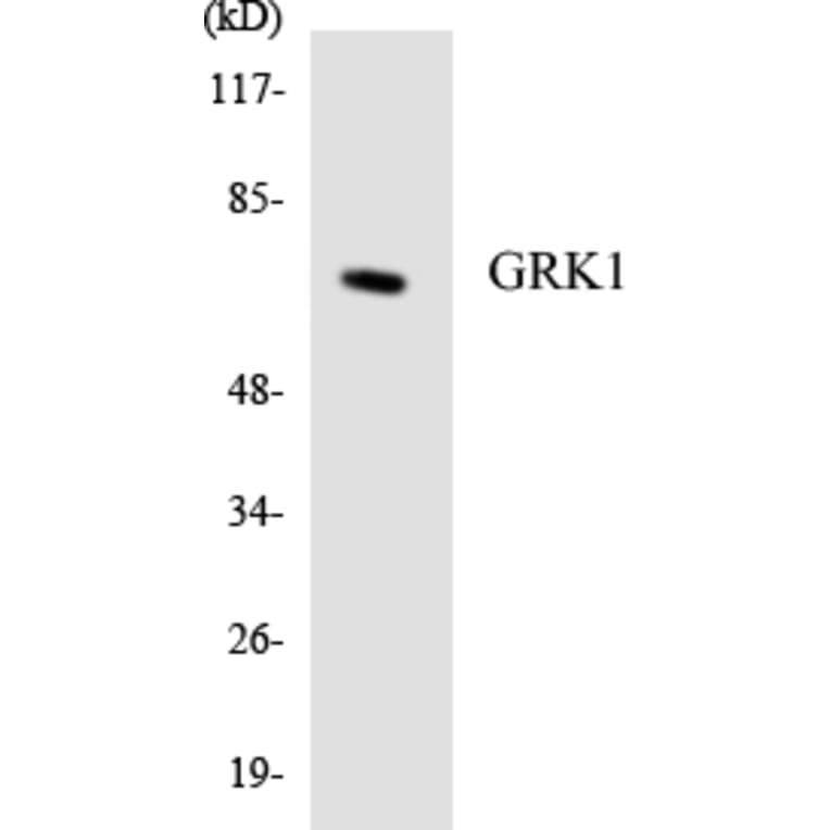 Western Blot - Anti-GRK1 Antibody (R12-2857) - Antibodies.com