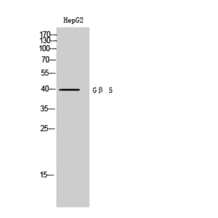 Western Blot - Anti-GNB5 Antibody (C16068) - Antibodies.com