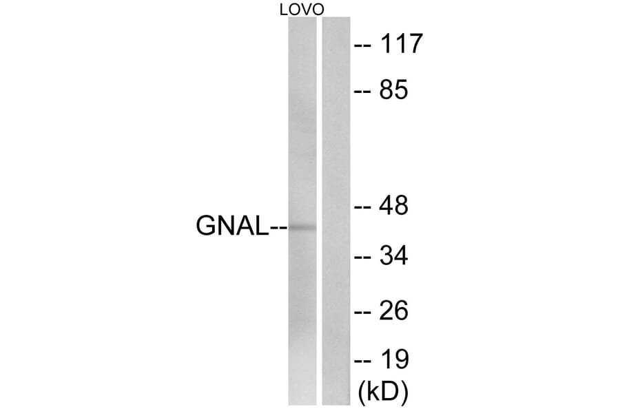 Western Blot - Anti-GNAL Antibody (C16057) - Antibodies.com