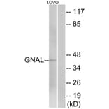 Western Blot - Anti-GNAL Antibody (C16057) - Antibodies.com