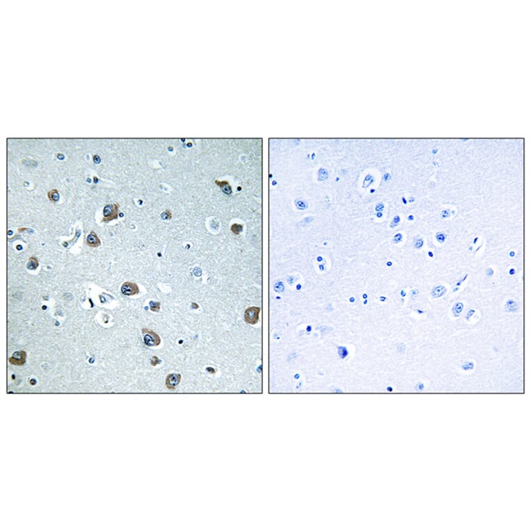 Immunohistochemistry - Anti-GNAL Antibody (C16057) - Antibodies.com