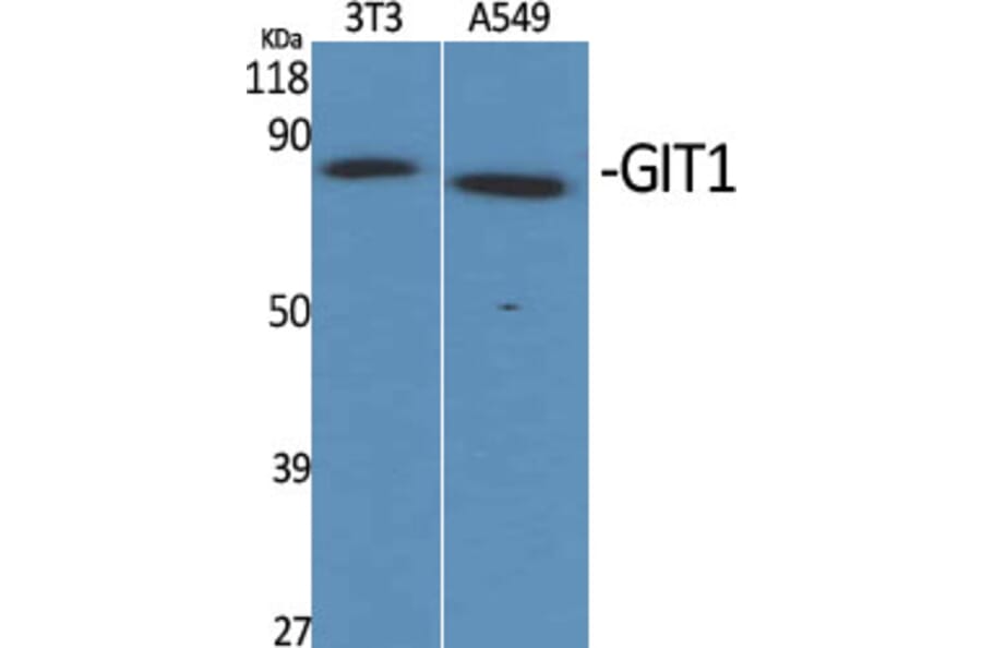 Western Blot - Anti-GIT1 Antibody (C11944) - Antibodies.com