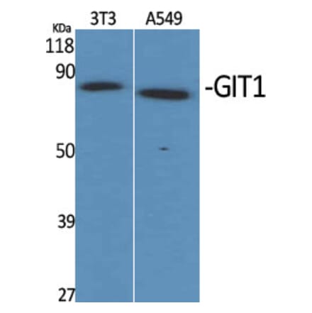 Western Blot - Anti-GIT1 Antibody (C11944) - Antibodies.com