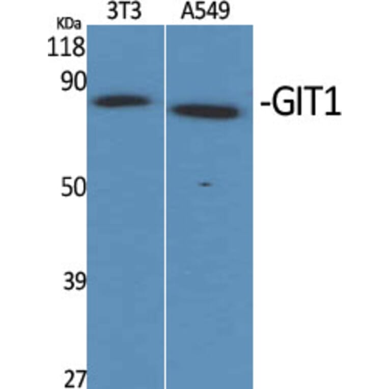 Western Blot - Anti-GIT1 Antibody (C11944) - Antibodies.com