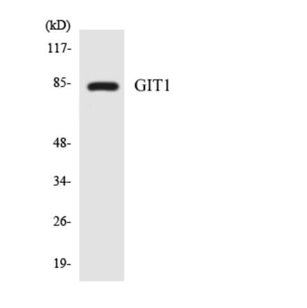 Western Blot - Anti-GIT1 Antibody (R12-2810) - Antibodies.com