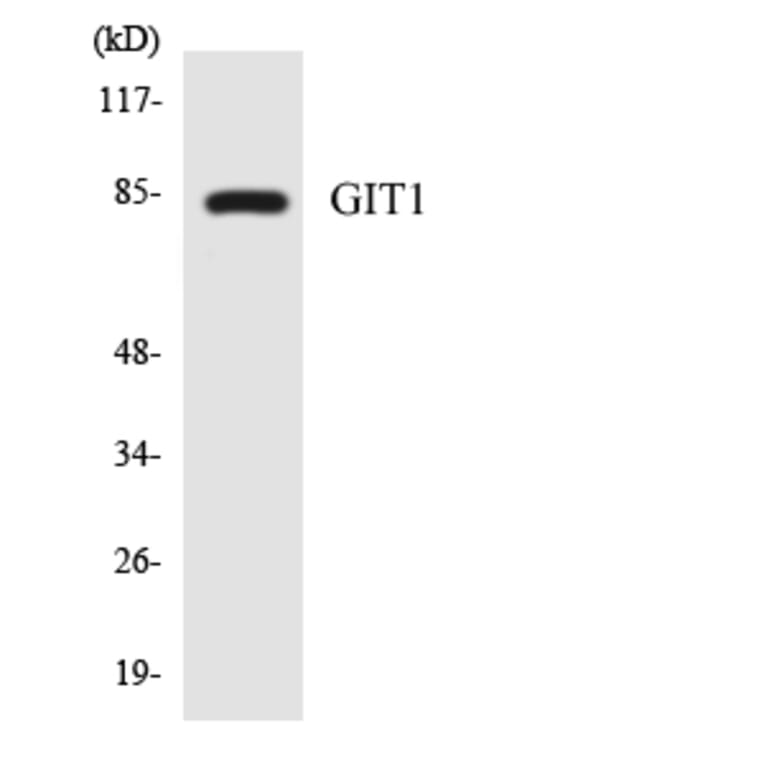 Western Blot - Anti-GIT1 Antibody (R12-2810) - Antibodies.com