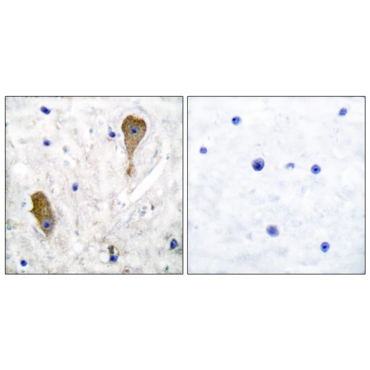 Immunohistochemistry - Anti-GAD1 Antibody (C0199) - Antibodies.com