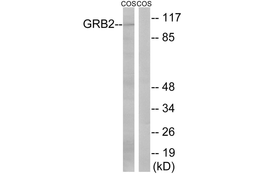 Western Blot - Anti-Gab2 Antibody (B8241) - Antibodies.com