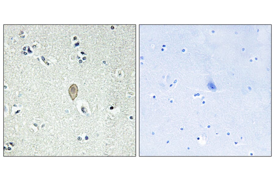 Immunohistochemistry - Anti-FZD5 Antibody (G110) - Antibodies.com