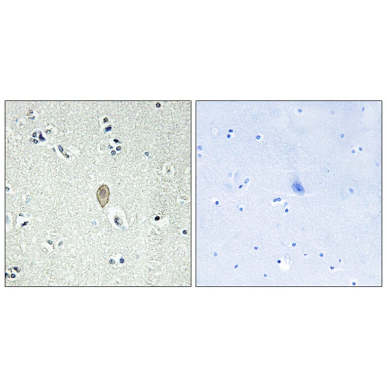 Immunohistochemistry - Anti-FZD5 Antibody (G110) - Antibodies.com