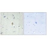 Immunohistochemistry - Anti-FZD5 Antibody (G110) - Antibodies.com